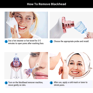Electric Blackhead Remover Pore Vacuum Suction Diamond Dermabrasion Face Cleaner - Home Brains And Brawn