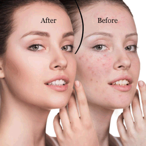 Electric Blackhead Remover Pore Vacuum Suction Diamond Dermabrasion Face Cleaner - Home Brains And Brawn