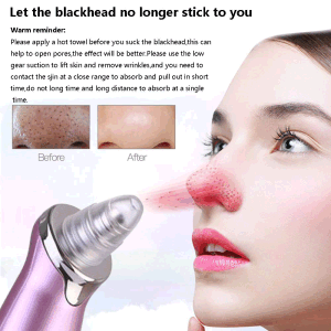 Electric Blackhead Remover Pore Vacuum Suction Diamond Dermabrasion Face Cleaner - Home Brains And Brawn