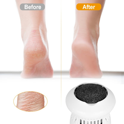 Electric Callus Grinder USB Rechargeable - Home Brains And Brawn
