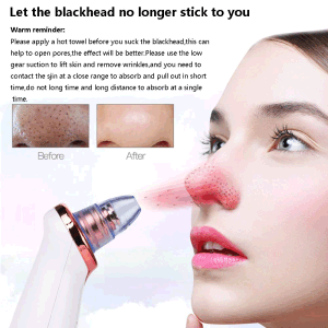 Electric Blackhead Remover Pore Vacuum Suction Diamond Dermabrasion Face Cleaner - Home Brains And Brawn